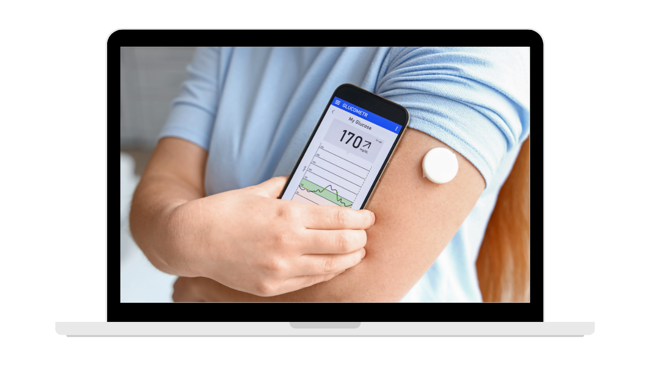 remote glucose monitoring